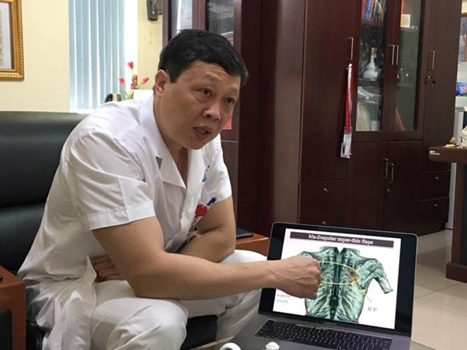 Vụ cô gái bị tạt axit: Bác sĩ ám ảnh vì một nửa khuôn mặt cháy đen-2