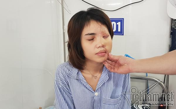 Hành trình hồi sinh gương mặt xinh đẹp cho cô gái bị thiếu úy tạt axit-4