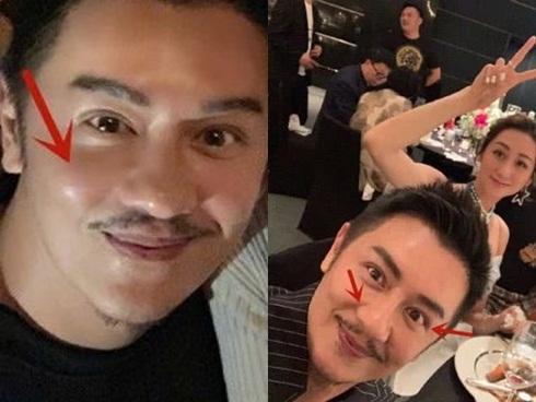 Đoàn Dự Trần Hạo Dân xuất hiện sau khi công khai thẩm mỹ-3