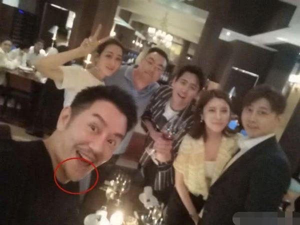 Xuất hiện với diện mạo bọng mắt sưng, đầu mũi to, Trần Hạo Dân phẫu thuật thẩm mỹ thất bại?-5