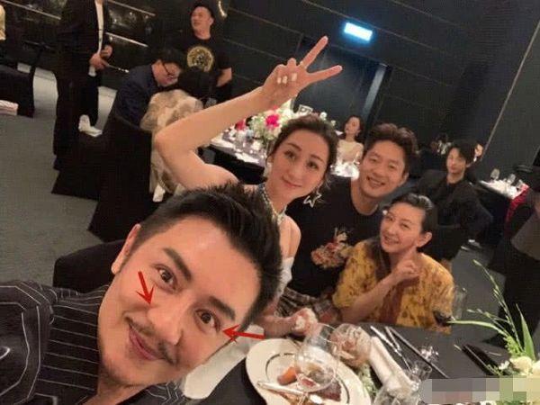 Xuất hiện với diện mạo bọng mắt sưng, đầu mũi to, Trần Hạo Dân phẫu thuật thẩm mỹ thất bại?-6