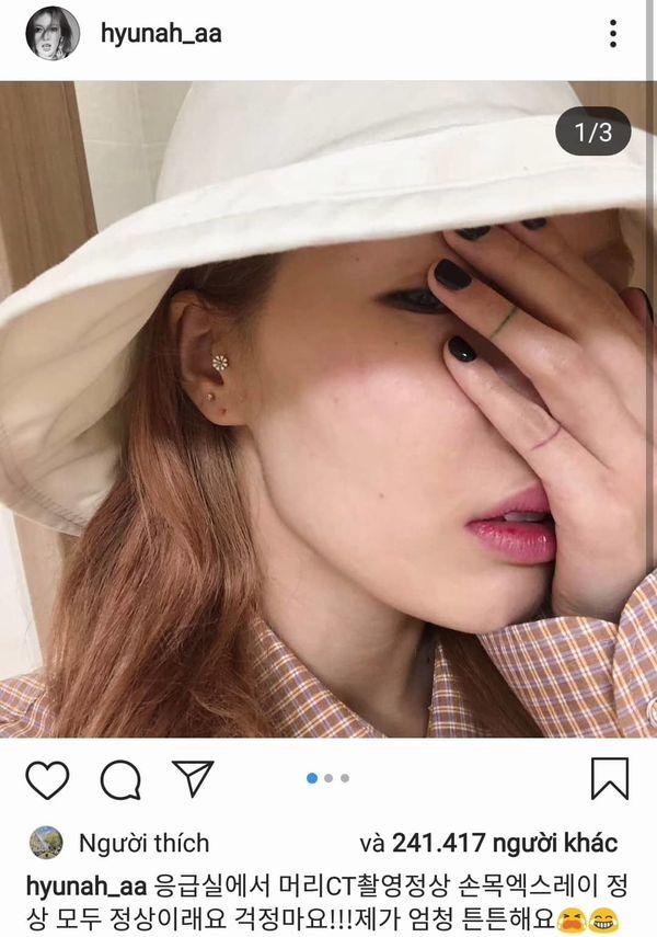 HyunA trấn an fan sau cú ngã trời giáng trên sân khấu: Tôi đã chụp CT đầu, quét X-Quang cổ tay,… mọi thứ rất ổn-1