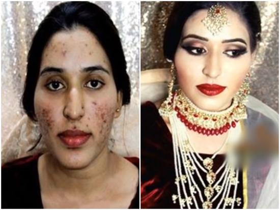 Cô dâu mặt mụn đến đâu chỉ cần một lớp trang điểm cũng thành nữ hoàng được hết