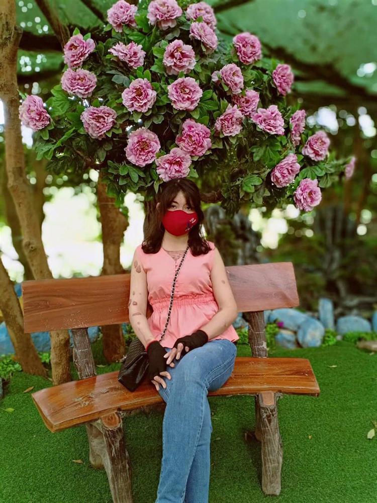 Cô gái Yên Bái bị chồng MC tẩm xăng đốt 3 năm trước giờ ra sao?-5