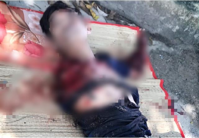 Kinh hoàng: Người đàn ông bị hổ cắn đứt lìa 2 cánh tay trong khu du lịch sinh thái-1