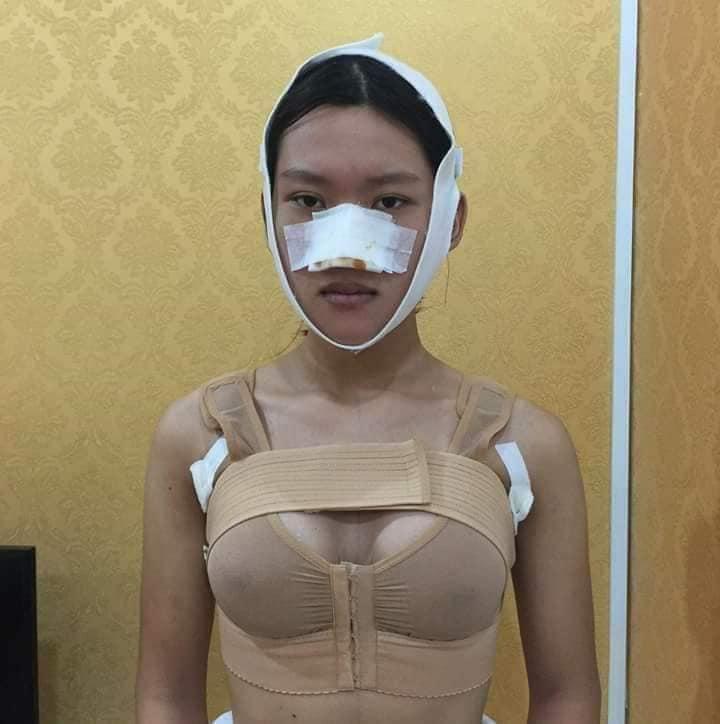 Công khai ảnh phẫu thuật chuyển giới, 9X Sài Gòn khiến người xem bất ngờ với màn lột xác xuất sắc-6