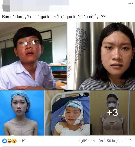 Công khai ảnh phẫu thuật chuyển giới, 9X Sài Gòn khiến người xem bất ngờ với màn lột xác xuất sắc-1