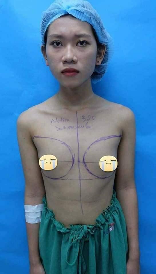 Công khai ảnh phẫu thuật chuyển giới, 9X Sài Gòn khiến người xem bất ngờ với màn lột xác xuất sắc-4