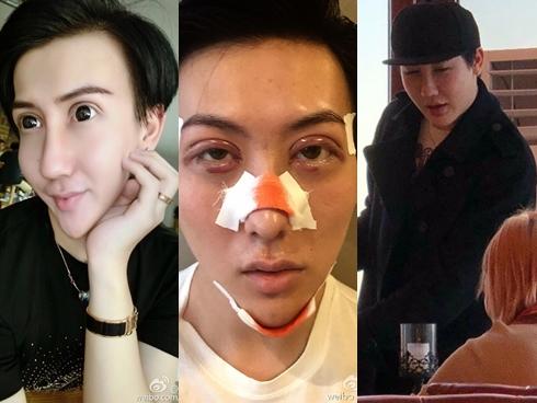 Chàng trai mặt rắn lộ thân hình như que củi sau thời gian vắng bóng-6