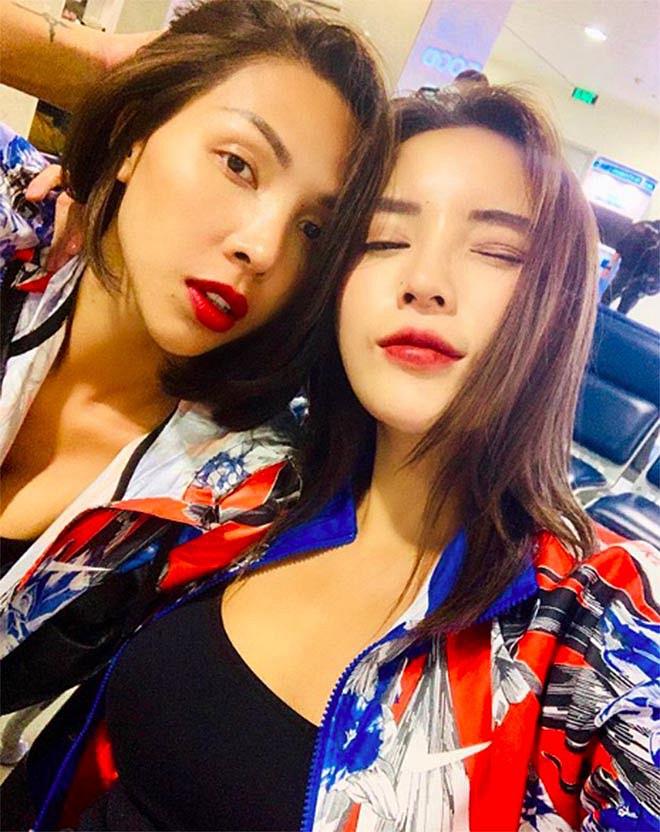 Vừa tái xuất sau thời gian mất tích, Kỳ Duyên khoe đôi chân sưng vù, bầm dập, loang lổ-1