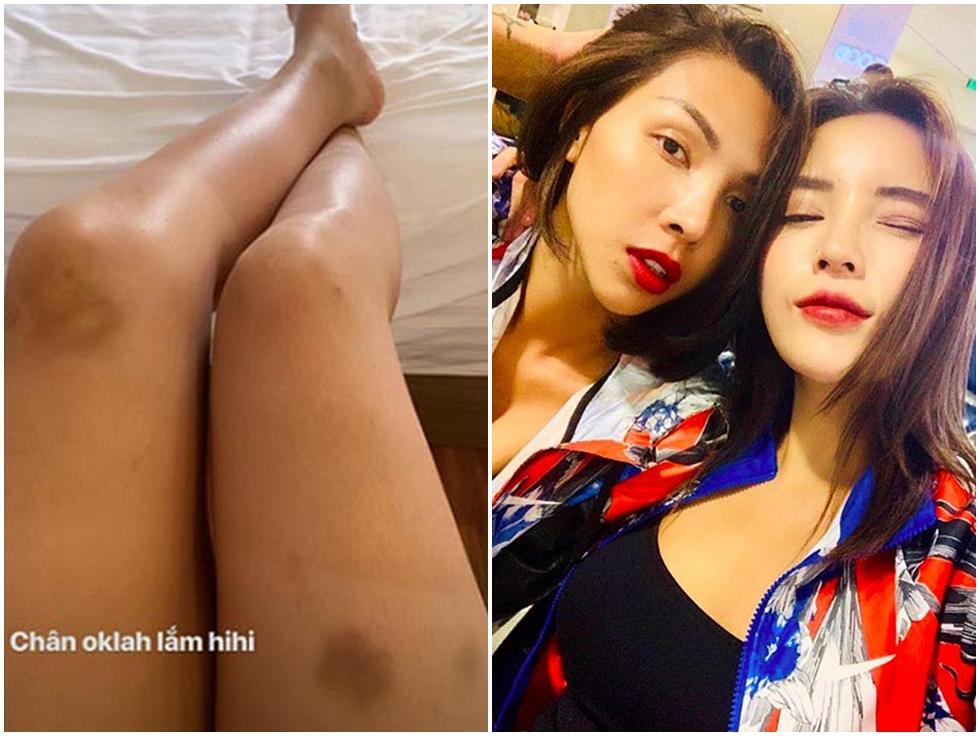 Béo đến mức photoshop mãi không ăn thua, Kỳ Duyên bắt đầu chiến dịch khâu miệng nghiêm khắc giảm cân-10