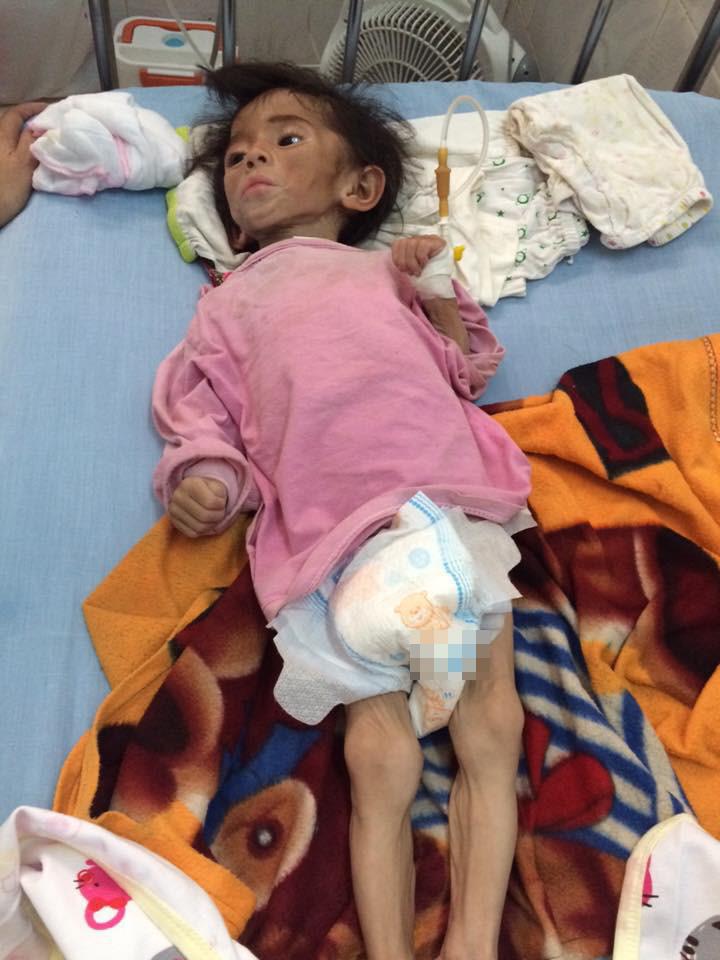 Hình ảnh mới nhất về bé gái suy dinh dưỡng ở Lào Cai được nhận nuôi 3 năm trước khiến ai nhìn cũng giật mình-1