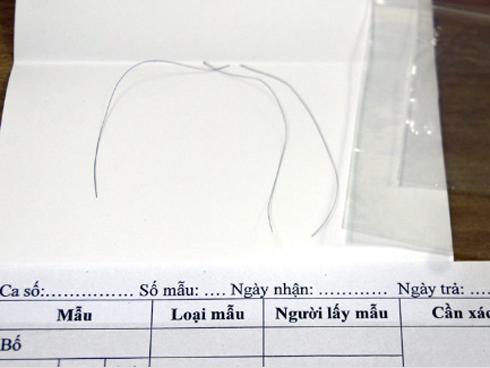 Ba lần thất vọng của anh Tây ở phòng xét nghiệm ADN Hà Nội