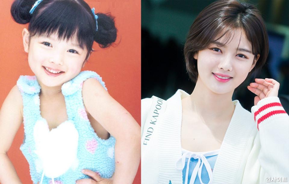 Hình ảnh ngày ấy - bây giờ của Kim Yoo Jung bất ngờ thu hút sự chú ý vì quá đẹp-1