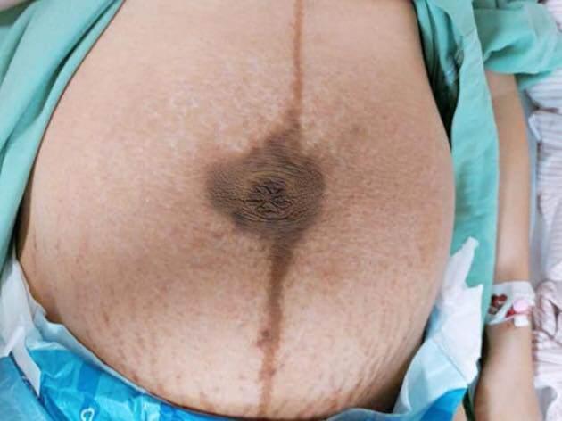 Mẹ 9X rùng mình kể chuyện đi đẻ, sau sinh đau rúm người nghe rõ mồn một từng mũi kim khâu-3