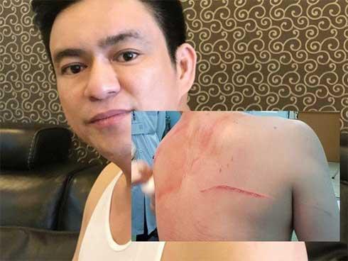 Vợ cũ bác sĩ Chiêm Quốc Thái chuẩn bị hầu tòa vì thuê người chém chồng-3