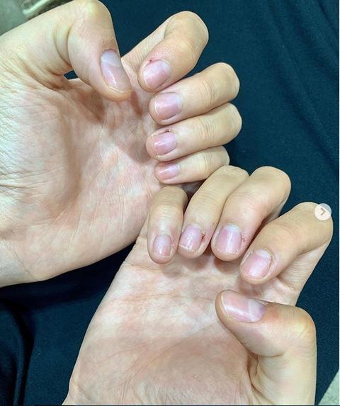 Hoa hậu Kỳ Duyên khiến fans xót xa với bàn tay bong tróc tơi tả vì bốc đất-2