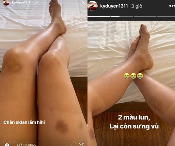 Hoa hậu Kỳ Duyên khiến fans xót xa với bàn tay bong tróc tơi tả vì bốc đất-5