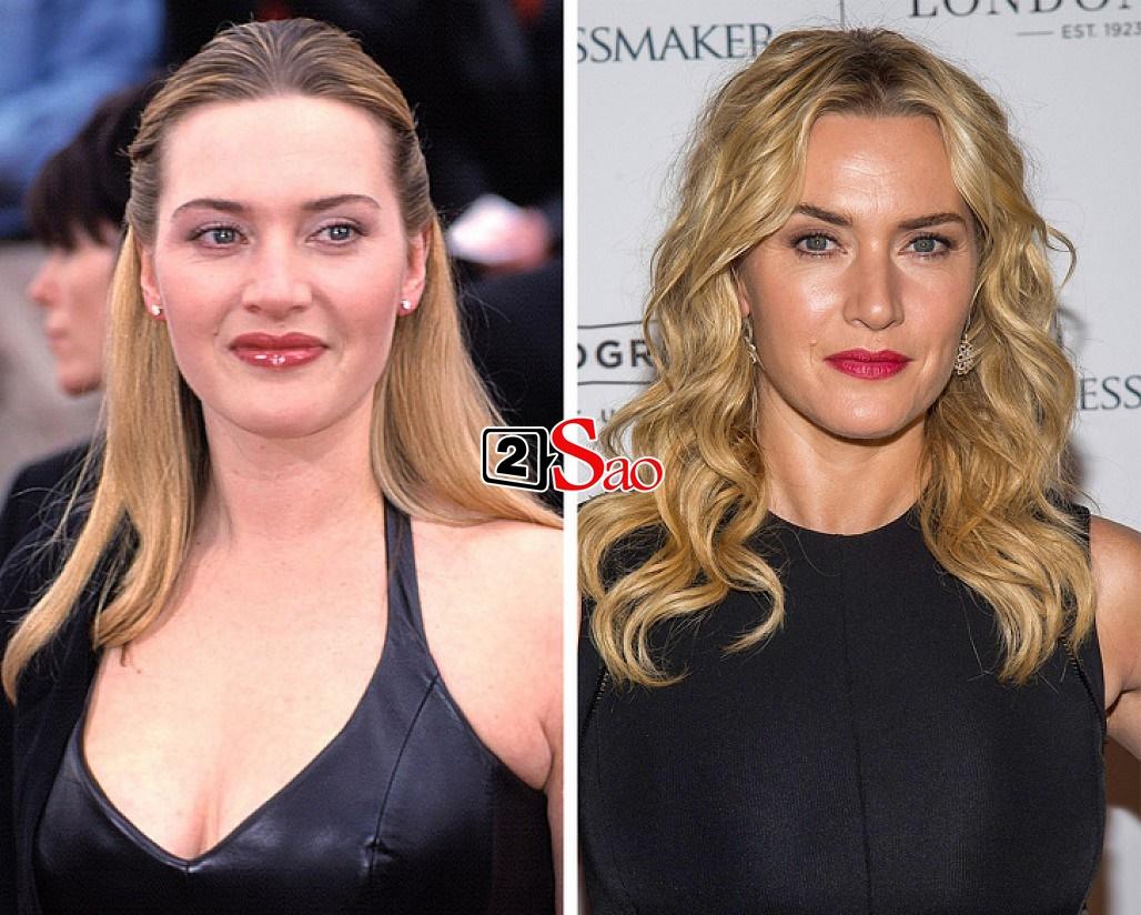 Kate Winslet ở hai thời điểm năm 2001 và 2016. Mỹ nhân phim “Titanic” xinh đẹp lên theo thời .