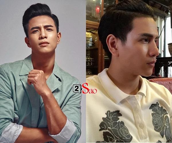 Nam vương Trịnh Bảo vướng nghi án thẩm mỹ, dân mạng kêu trời: Đẹp hơn Kim Lý mà giờ sửa thấy ghê-3