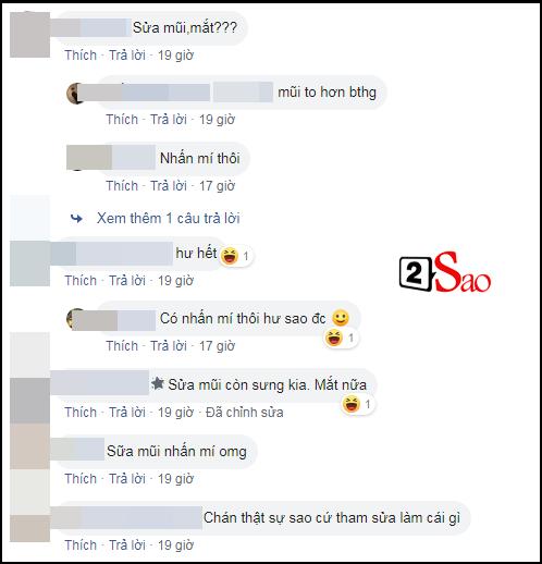 Nam vương Trịnh Bảo vướng nghi án thẩm mỹ, dân mạng kêu trời: Đẹp hơn Kim Lý mà giờ sửa thấy ghê-4