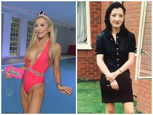 'Búp bê bà già' phẫu thuật thẩm mỹ nhiều nhất thế giới