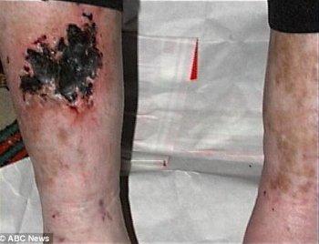 Đằng sau hào quang, chẳng ai thấy loạt chấn thương từ việc trình diễn đến di chứng suốt đời của sao US-UK-2