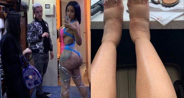 Đằng sau hào quang, chẳng ai thấy loạt chấn thương từ việc trình diễn đến di chứng suốt đời của sao US-UK-5