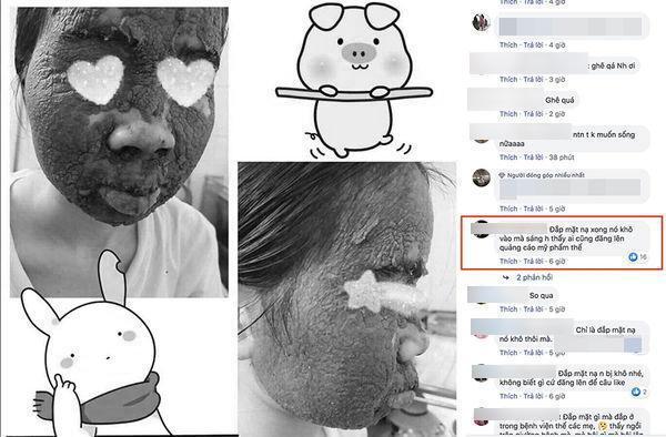 Nhầm tưởng lên đời nhan sắc nhờ rượu thuốc, cô gái khóc ròng vì làn da nham nhở, sần sùi-3