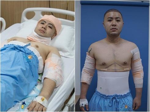 Sao nam Việt nhận ý kiến trái chiều khi công khai phẫu thuật thẩm mỹ-15