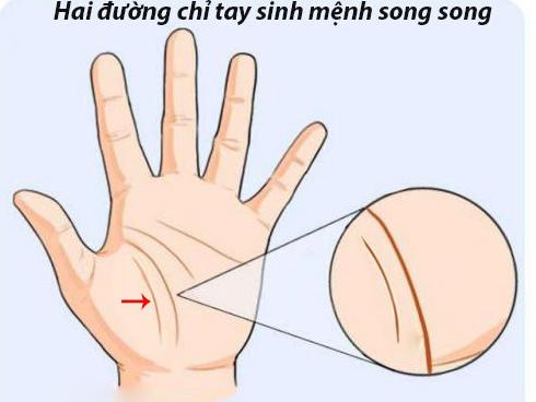 Xem chỉ tay đường sinh mệnh biết ngay người bệnh tật hay khỏe mạnh, ai phúc dày mệnh lớn