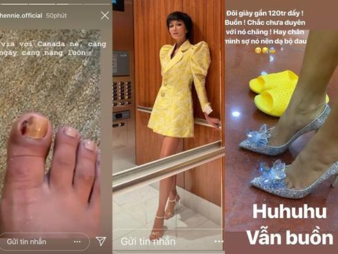 Tậu đôi giày 120 triệu trong mơ của hàng vạn cô gái nhưng H'Hen Niê không thể đi được lâu vì chân sưng tấy