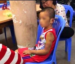 Câu chuyện cuối tuần: Phẫn uất nhìn bé trai bị mẹ ruột và BẠN TÌNH ĐỒNG TÍNH tra tấn dã man, thâm tím hết người-2