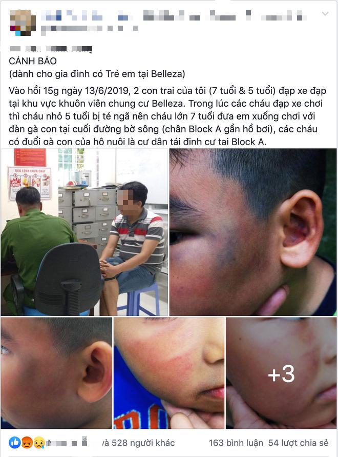 TP. HCM: Cha bức xúc tố con trai 7 tuổi bị đánh chảy máu mũi, phù nề mặt vì nghi trộm gà trong khu chung cư-1
