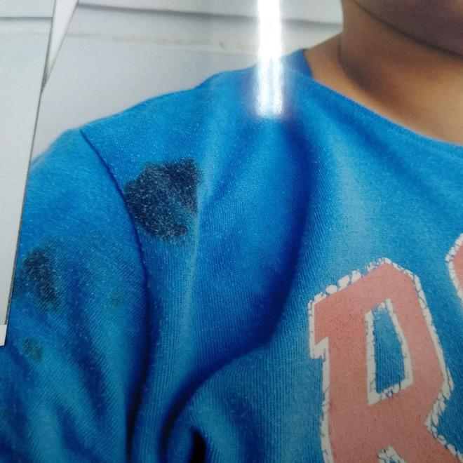 TP. HCM: Cha bức xúc tố con trai 7 tuổi bị đánh chảy máu mũi, phù nề mặt vì nghi trộm gà trong khu chung cư-3