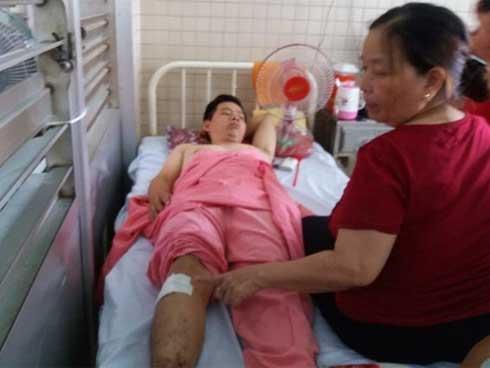 Bệnh viện Chợ Rẫy xin lỗi người bệnh vụ khoan nhầm cẳng chân-2