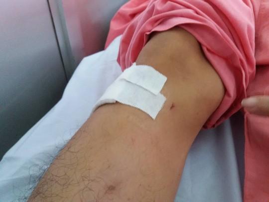 Bệnh viện Chợ Rẫy xin lỗi người bệnh vụ khoan nhầm cẳng chân-1