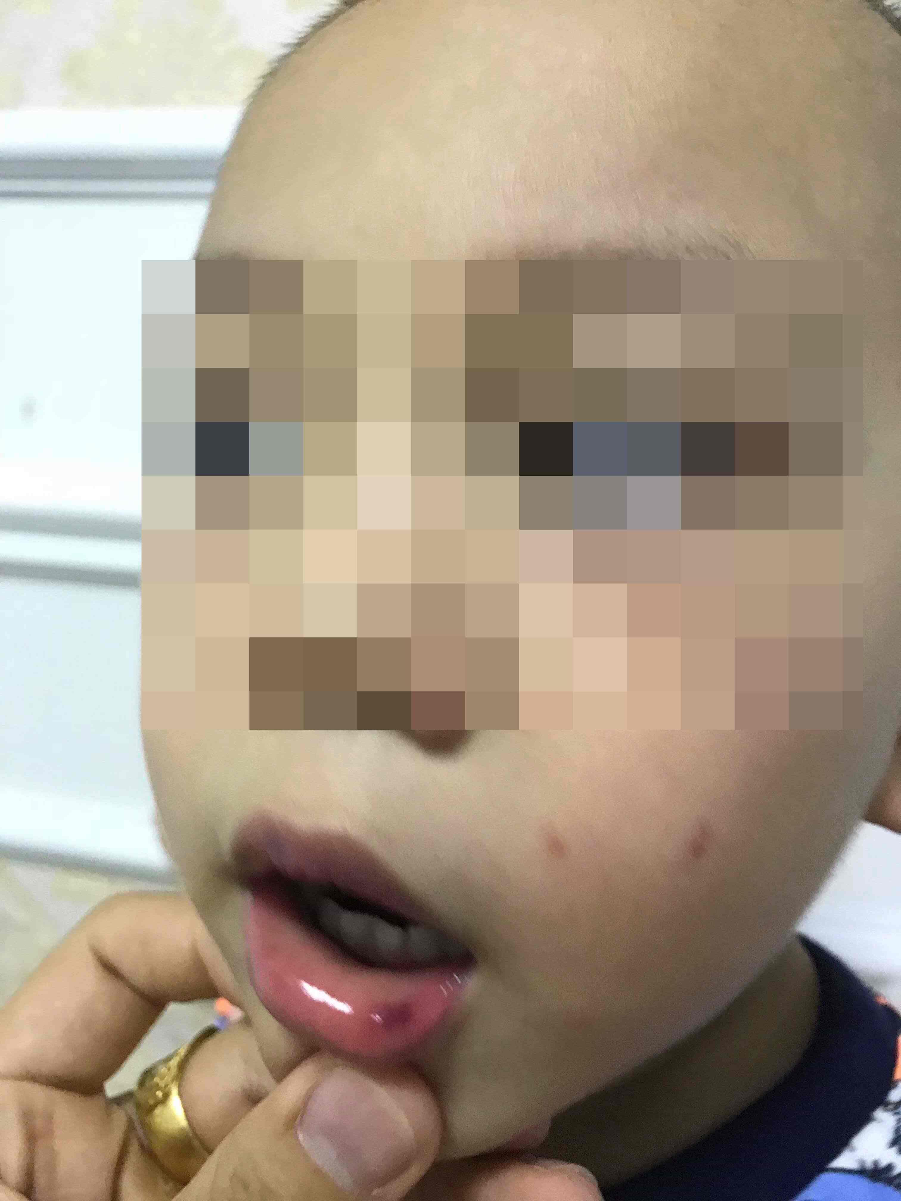 Hé lộ clip cô giáo bị camera an ninh bóc phốt cảnh tát bé 3 tuổi ngã sấp mặt, tụ máu môi-1
