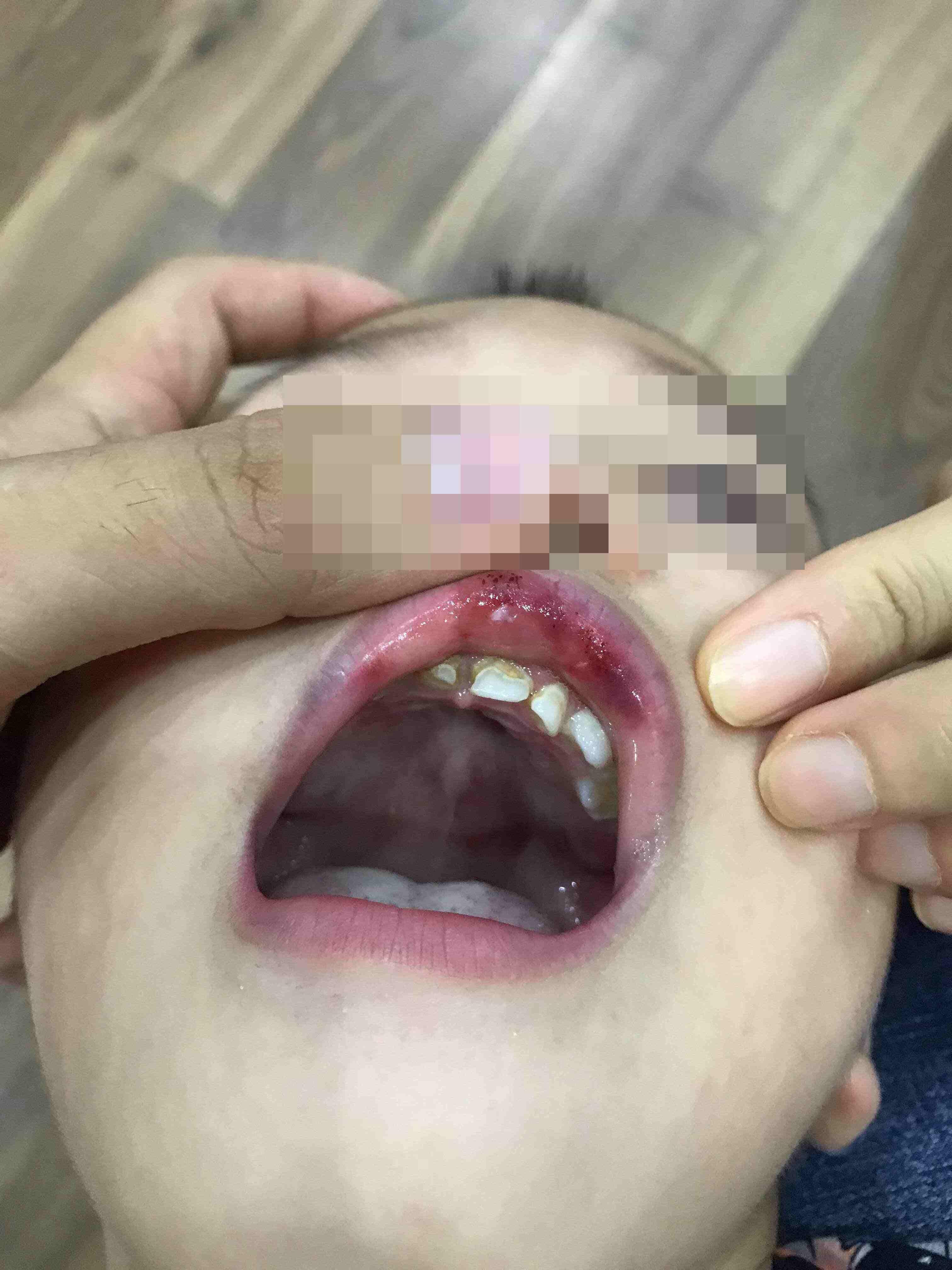 Hé lộ clip cô giáo bị camera an ninh bóc phốt cảnh tát bé 3 tuổi ngã sấp mặt, tụ máu môi-2