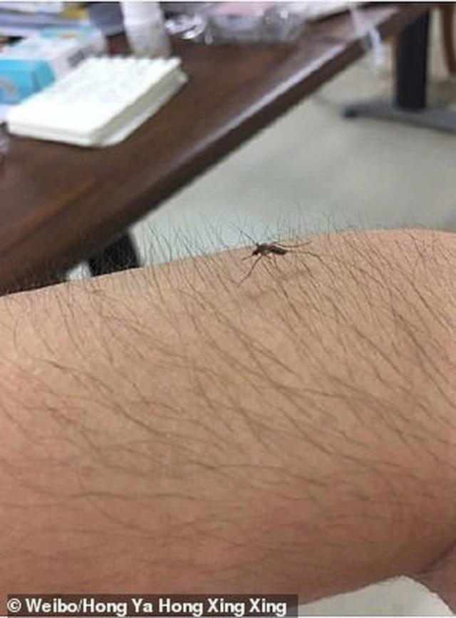 Các thiếu nữ Trung Quốc thi nhau khoe lông tay, lông chân dày đến mức muỗi cũng không đốt nổi-4