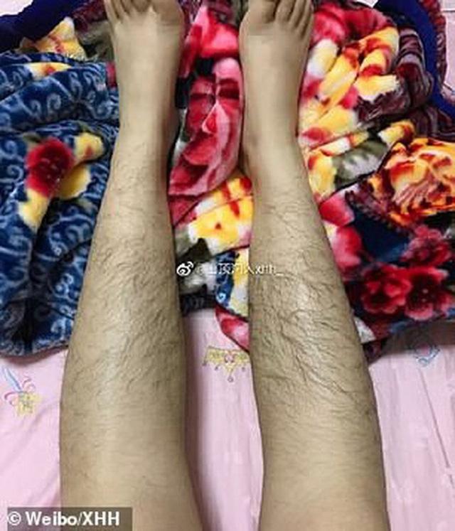 Các thiếu nữ Trung Quốc thi nhau khoe lông tay, lông chân dày đến mức muỗi cũng không đốt nổi-7