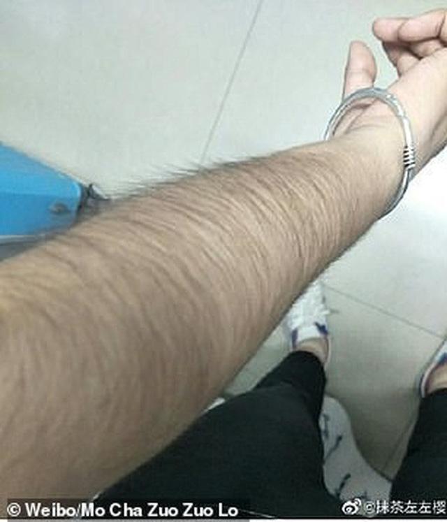 Các thiếu nữ Trung Quốc thi nhau khoe lông tay, lông chân dày đến mức muỗi cũng không đốt nổi-6