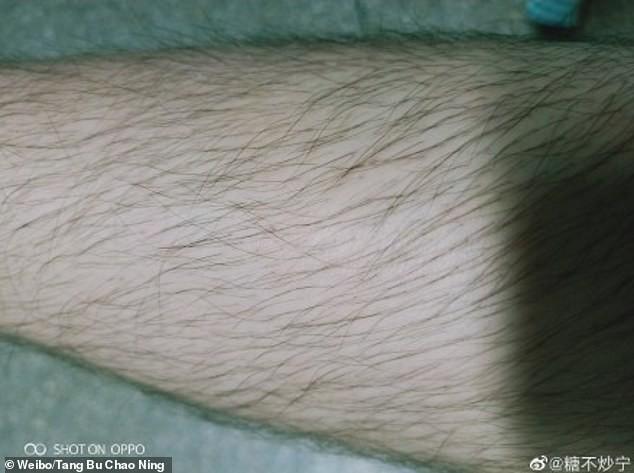 Các thiếu nữ Trung Quốc thi nhau khoe lông tay, lông chân dày đến mức muỗi cũng không đốt nổi-8