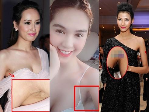Đâu chỉ riêng Ngọc Trinh, nhiều mỹ nhân Việt xinh tuyệt đỉnh nhưng vùng nách thâm đen lại không thể giấu đâu cho kỹ