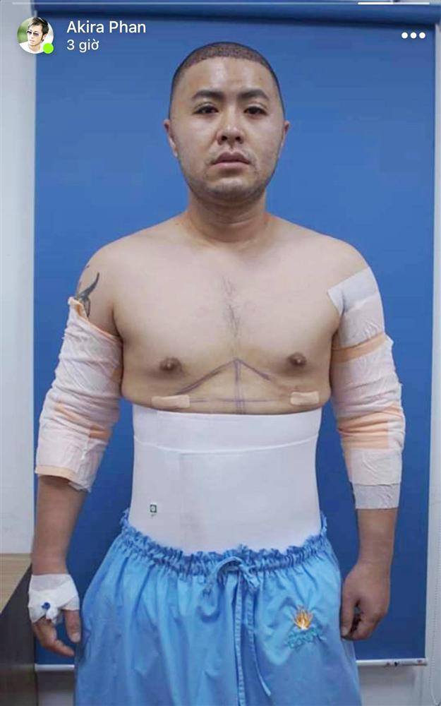 Hoàng tử Mùa đông không lạnh Akira Phan sau phẫu thuật để lấy lại phong độ giờ ra sao?-5
