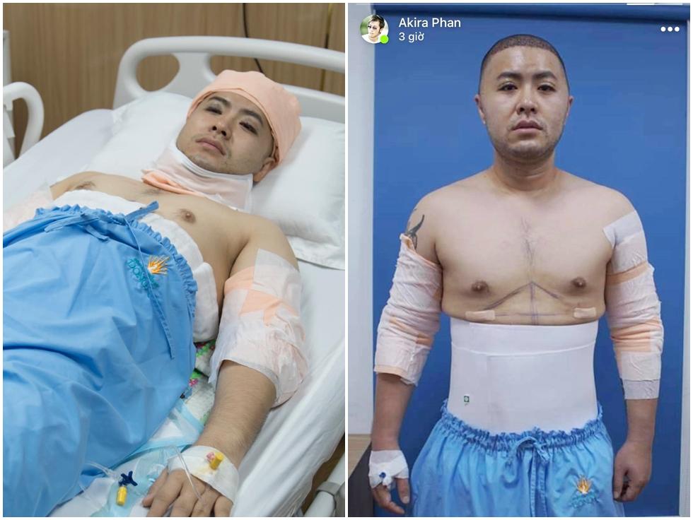 Akira Phan lần đầu kể lại hành trình giảm mỡ đầy khổ cực-5