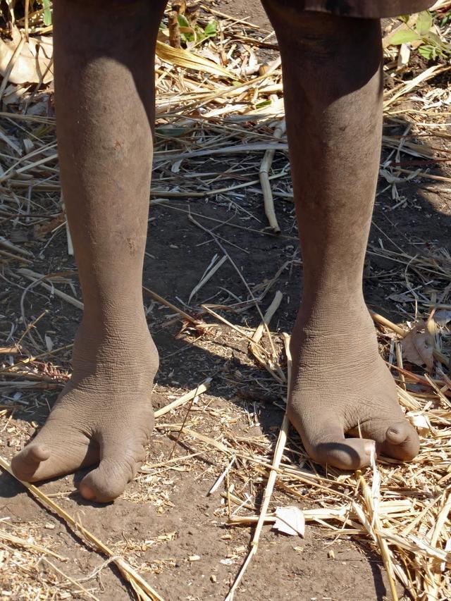 Bộ lạc chân đà điểu kỳ lạ ở châu Phi-3