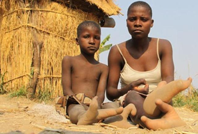 Bộ lạc chân đà điểu kỳ lạ ở châu Phi-4