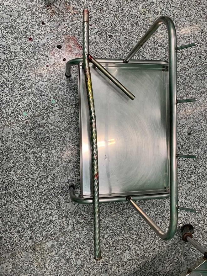 Nhìn thôi đã hãi: Đi ăn trộm bị phát hiện, tên trộm nhảy lầu chạy trốn bị cây inox dài 1,5m xuyên qua hậu môn...-2