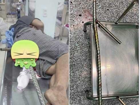 Mâu thuẫn gia đình, cháu ngoại đánh bà gãy 5 xương sườn-3